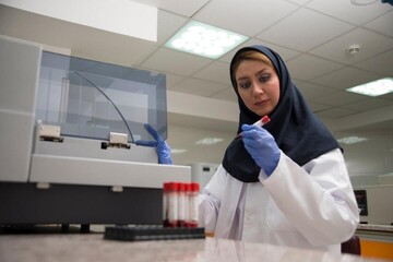 علت کاهش درخواست بیمه بیکاری چه بود؟